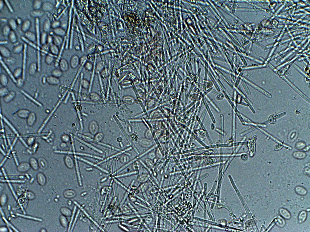 Objetivo de 40x<br />M.BACTERIAS