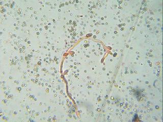 Seudohifa de candida Imagen 136.jpg