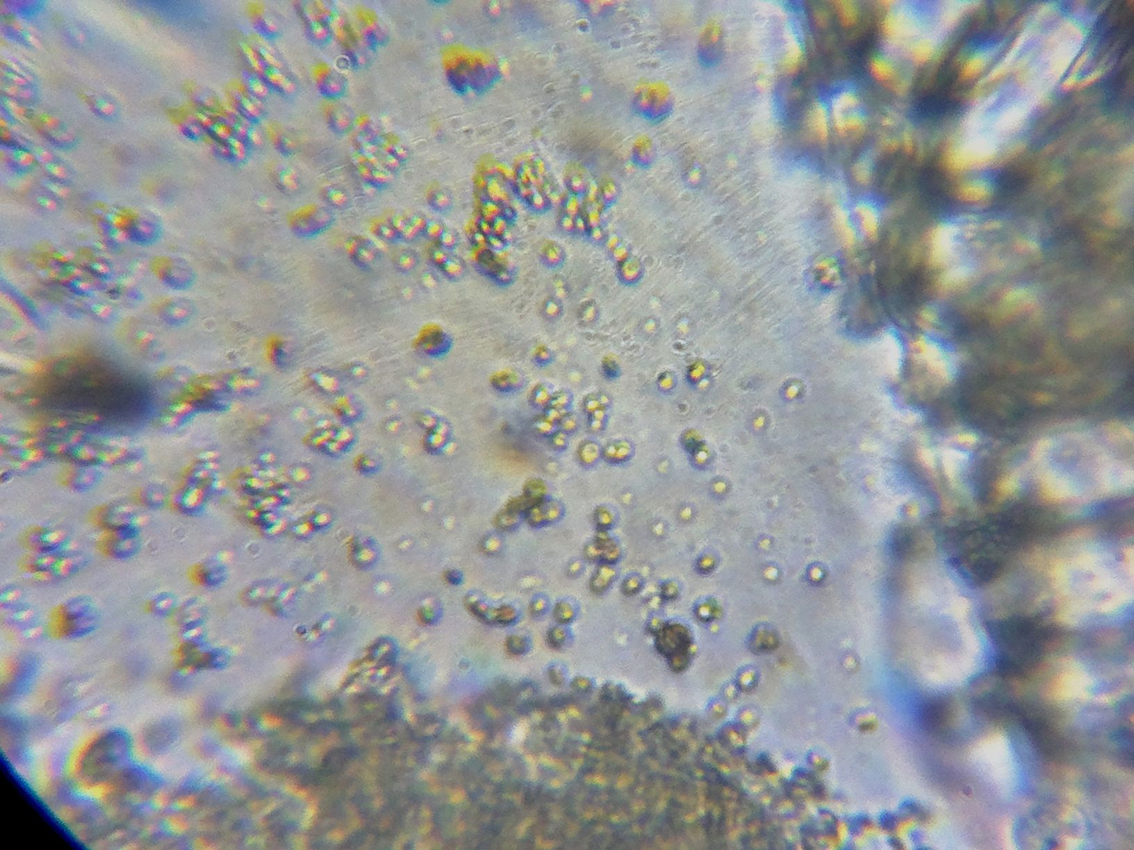 foto con el movil<br />ocular 10x   objetivo 40x