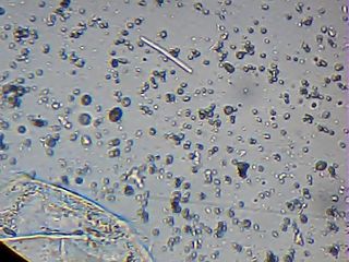 mega  bacteria