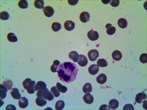 Granulocito eosinófilo-1.jpg