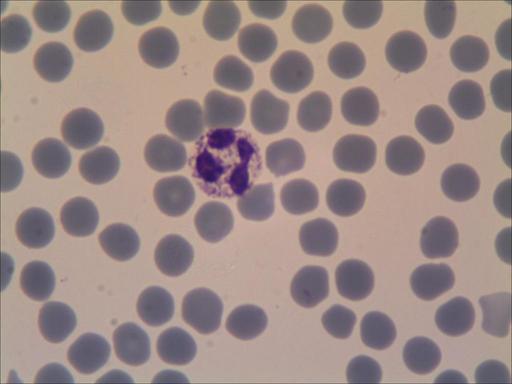 Granuocito neutrofilo-1.jpg