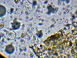 ocular 10x objetivo 40x<br /> ¿hay bacterias?