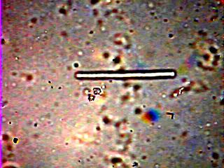 mega bacteria  objetivo 100x