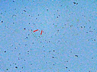 megas bacterias <br />objetivo de 40x