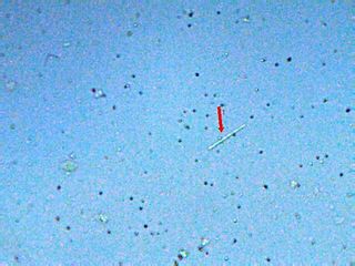 megas bacterias <br />objetivo de 40x