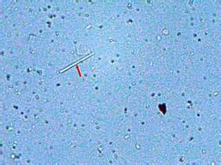 megas bacterias <br />objetivo de 40x