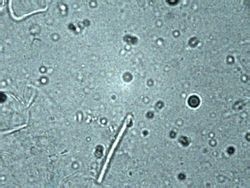 megas bactreria <br />objetivo de 100x