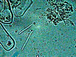 megas bactreria <br />objetivo de 100x