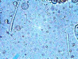 megas bactreria <br />objetivo de 100x