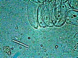 megas bactreria <br />objetivo de 100x