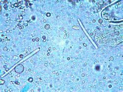 megas bactreria <br />objetivo de 100x