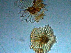tricoma de una olivera de jardin<br />objetivo de 40x