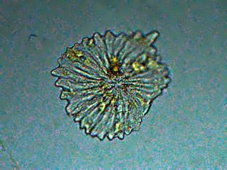 tricoma de una olivera de jardin<br />objetivo de 40x
