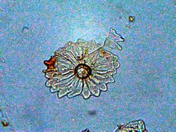 tricoma de una olivera de jardin<br />objetivo de 40x