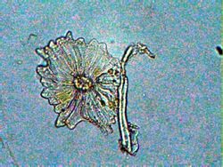 tricoma de una olivera de jardin<br />objetivo de 40x