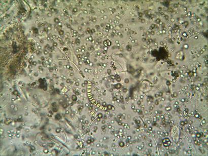 espirulina digerida-1.JPG