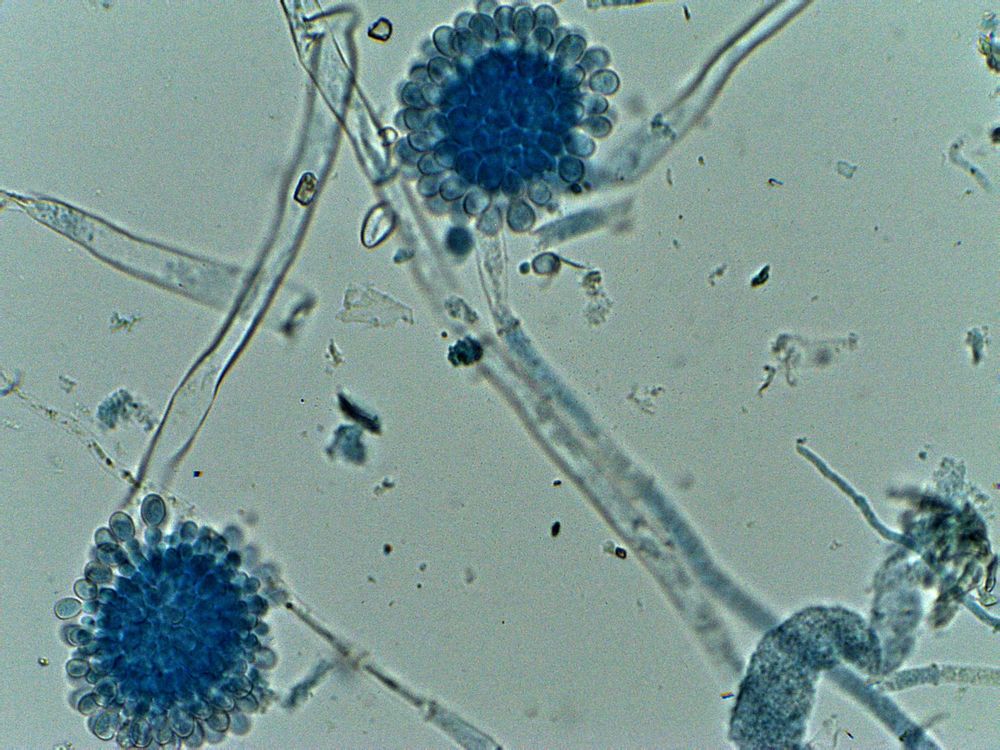 objetivo de 40x<br />hongos levaduriformes