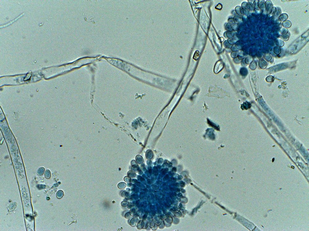 objetivo de 40x<br />hongos levaduriformes