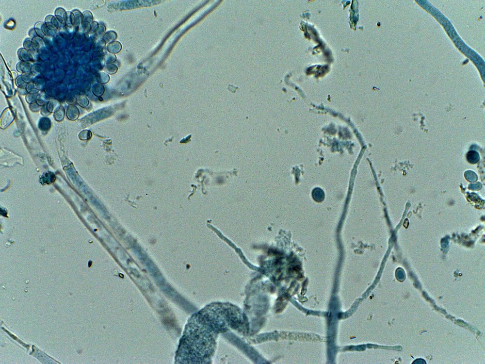objetivo de 40x<br />hongos levaduriformes
