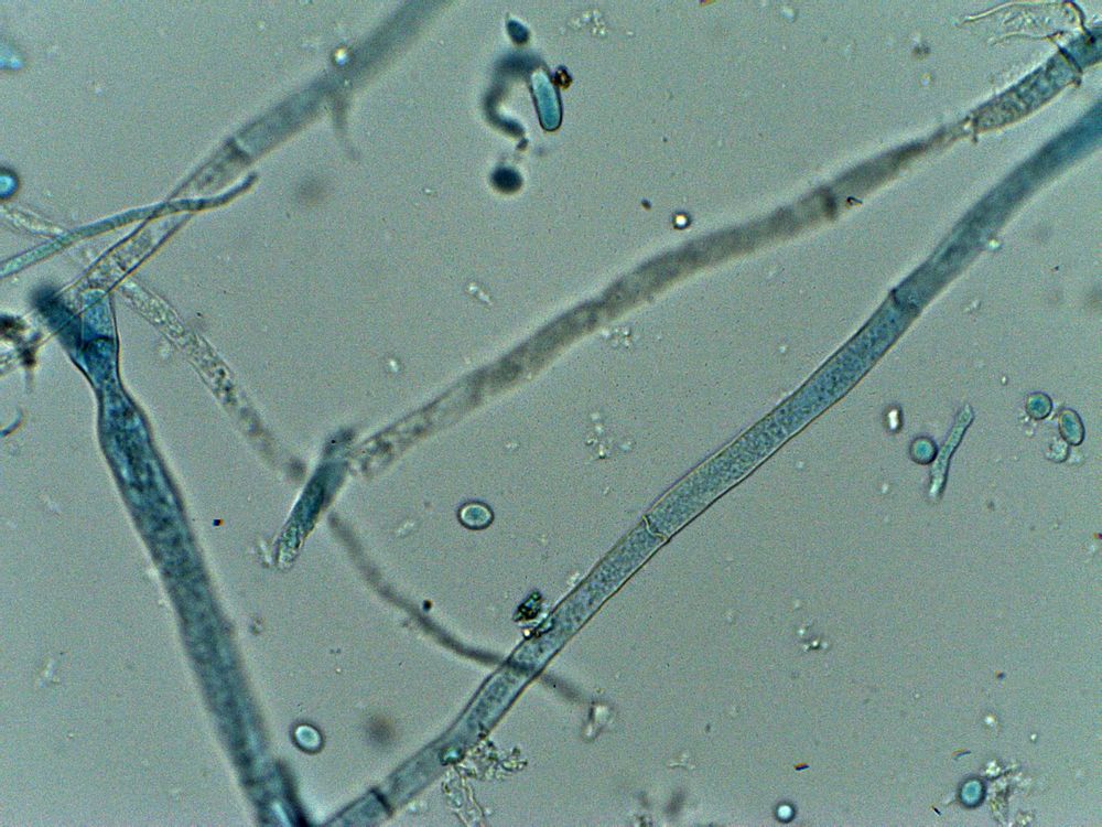 objetivo de 40x<br />hongos levaduriformes