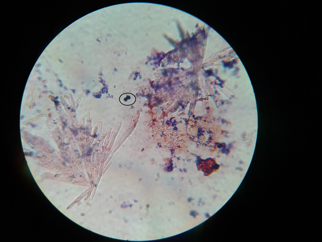levadura gram+ (azul-15) II retoke.jpg