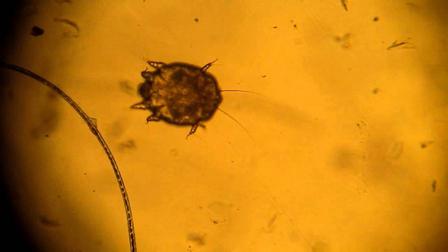 Cnemidocoptes mutans.jpg