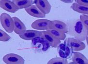 Atoxoplasma (Blue crowned laughing thrusth Frotis sanguineo.JPG