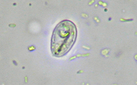 quiste Giardia SS.jpg