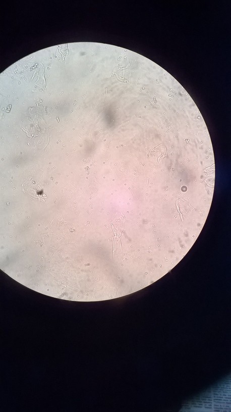 muestra de la paloma infectada ya sin infeccion