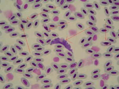 trypanosoma en sangre de ave.JPG