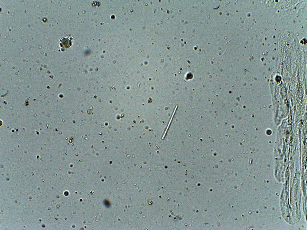 objetivo de 40x<br />mega bacteria