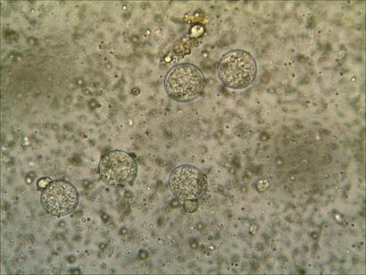 ooquistes isospora.jpg