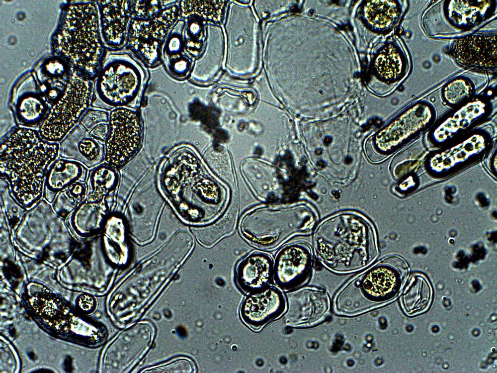 objetivo de 40x<br />parasito hoja tomatera