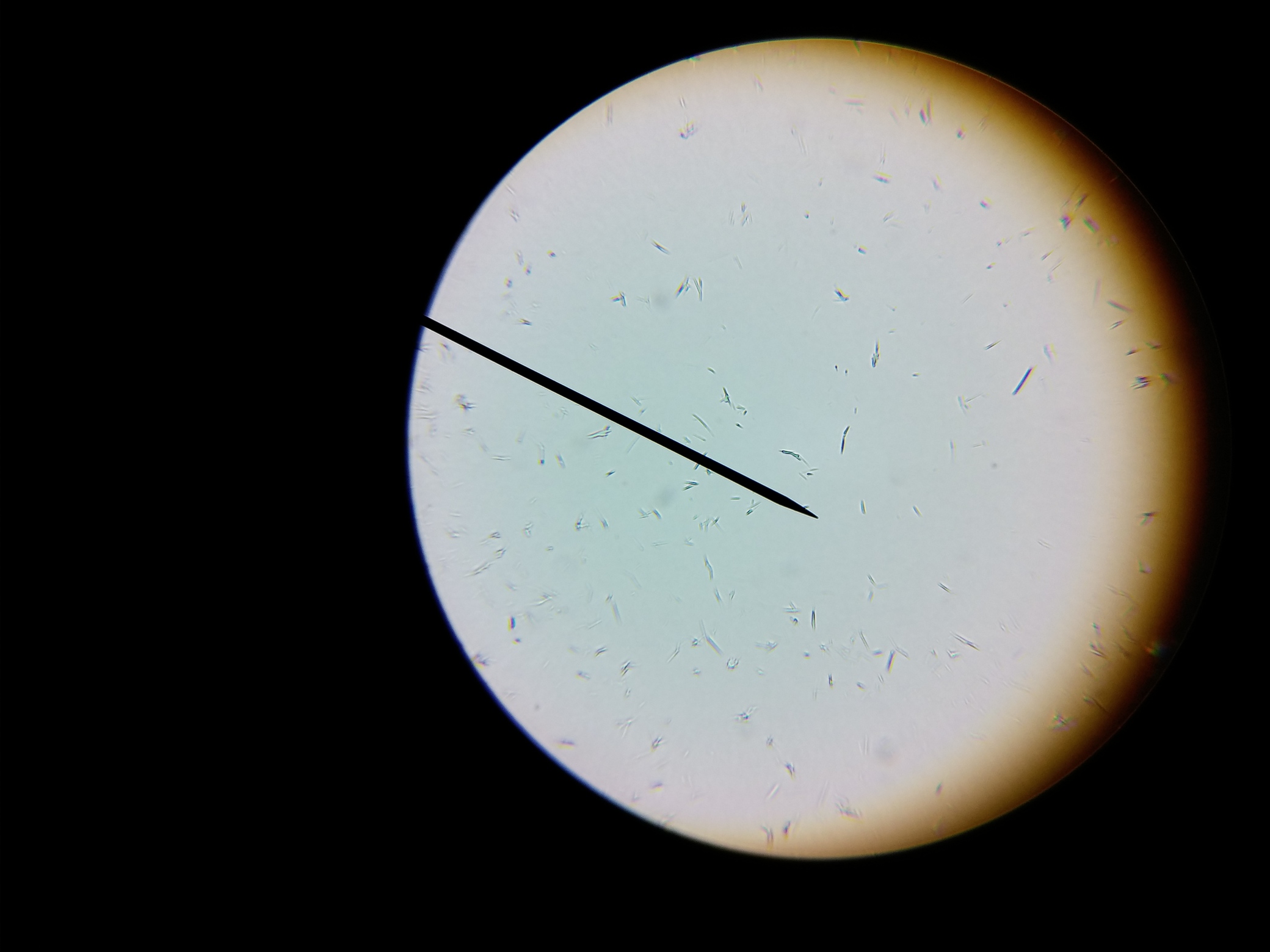 megabacterias?