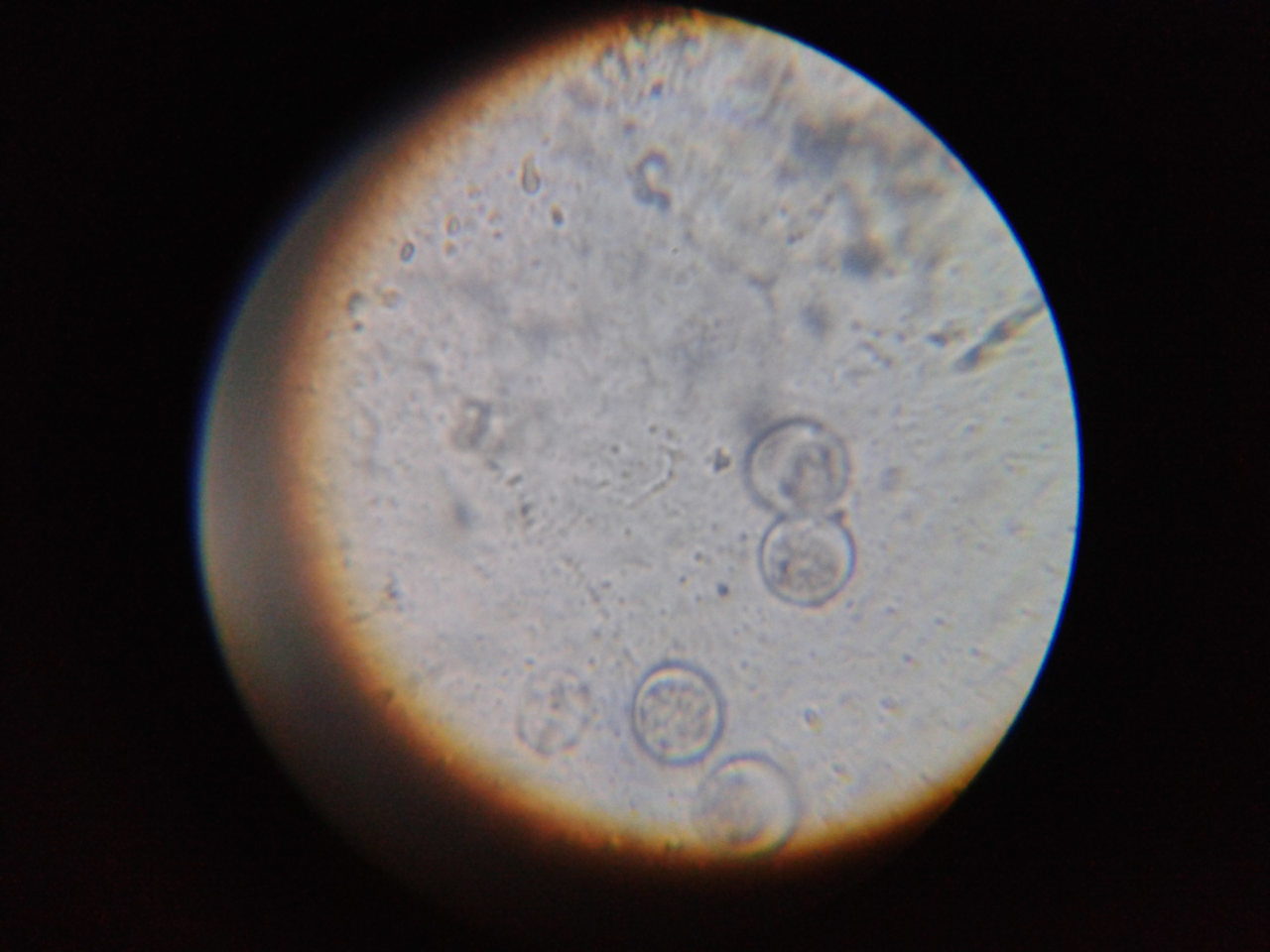 El tratamiento a sido de baycox 4 gotas en 40ml